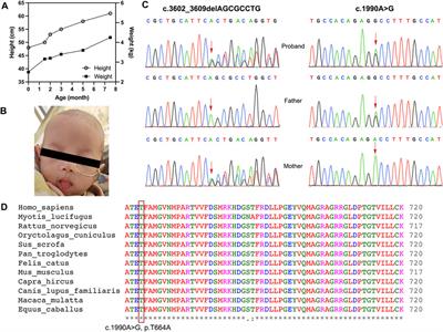 Case Report: Novel Compound-Heterozygous Variants of SKIV2L Gene that Cause Trichohepatoenteric Syndrome 2